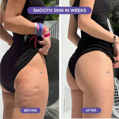 SculptRoller™ — Sculpt, Tone & Transform in Minutes