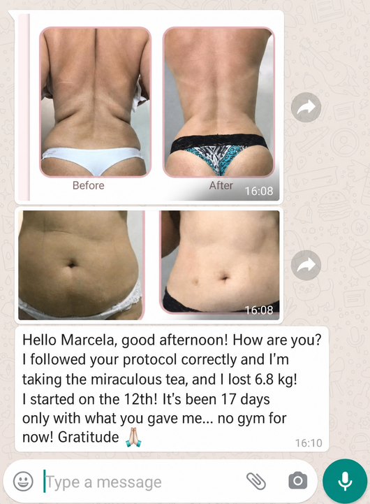 SculptRoller™ — Sculpt, Tone & Transform in Minutes